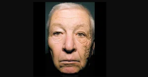 Daños en lado izquierdo del rostro